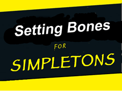setting bones for simpletons